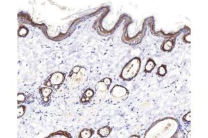 Immunohistochemistry analysis of paraffin-embedded rat skin using CK-17 Polyclonal Antibody at dilution of 1:400. (KRT17 抗体)