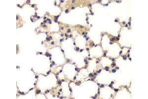 Immunohistochemistry of paraffin-embedded Mouse lung using CXXC1 Polyclonal Antibody at dilution of 1:200 (40x lens). (CXXC1 抗体)