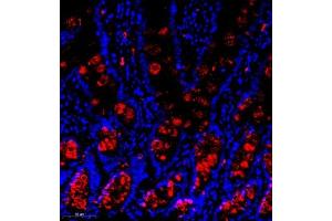 Immunofluorescence (Paraffin-embedded Sections) (IF (p)) image for anti-Solute Carrier Family 30 (Zinc Transporter), Member 1 (SLC30A1) antibody (ABIN7075672)