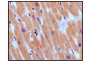 Immunohistochemical analysis of paraffin-embedded human normal myocardium, showing cytoplasmic localization using BNP3 mouse mAb with DAB staining. (BNP 抗体)