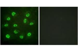 Immunofluorescence analysis of HuvEc cells, using Estrogen Receptor-beta (Phospho-Ser105) Antibody.