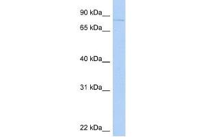 KIF2C antibody used at 1 ug/ml to detect target protein.