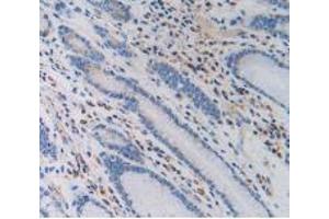 IHC-P analysis of Human Stomach Tissue, with DAB staining. (PZP 抗体  (AA 1212-1391))