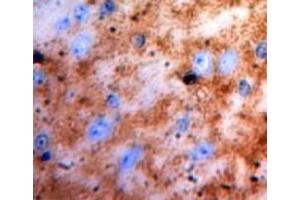 Used in DAB staining on fromalin fixed paraffin-embedded brain tissue (S100 Protein (S100) (AA 1-94) 抗体)