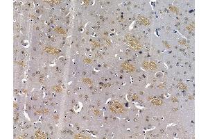 ABIN7096472 and ABIN7100536 at 1/100 staining rat brain tissue by IHC-P.