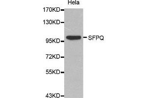Western Blotting (WB) image for anti-Splicing Factor Proline/glutamine-Ric (SFPQ) (AA 578-707) antibody (ABIN6214046) (SFPQ 抗体  (AA 578-707))
