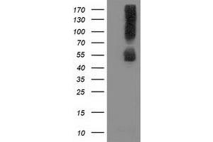 Image no. 2 for anti-Sequestosome 1 (SQSTM1) antibody (ABIN1499987) (SQSTM1 抗体)
