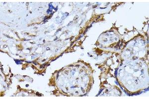 Immunohistochemistry (Paraffin-embedded Sections) (IHC (p)) image for anti-Ribosomal Protein S27a (RPS27A) antibody (ABIN7260073)