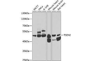 Western blot analysis of extracts of various cell lines, using TSEN2 antibody (ABIN6131375, ABIN6149615, ABIN6149616 and ABIN6223809) at 1:1000 dilution. (TSEN2 抗体  (AA 1-220))