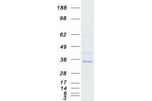 Western Blotting (WB) image for Ras Association (RalGDS/AF-6) Domain Family Member 4 (RASSF4) protein (Myc-DYKDDDDK Tag) (ABIN2730563)