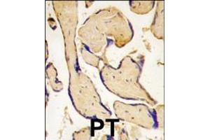 Formalin-fixed and paraffin-embedded human placenta tissue reacted with EphA3 antibody (C-term ), which was peroxidase-conjugated to the secondary antibody, followed by DAB staining. (EPH Receptor A3 抗体  (C-Term))