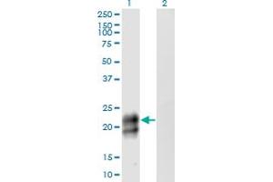 Western Blotting (WB) image for anti-Tumor Necrosis Factor Receptor Superfamily, Member 17 (TNFRSF17) (AA 1-184) antibody (ABIN513690)