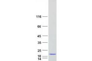 Western Blotting (WB) image for Chromosome 17 Open Reading Frame 37 (C17orf37) protein (Myc-DYKDDDDK Tag) (ABIN2715423)