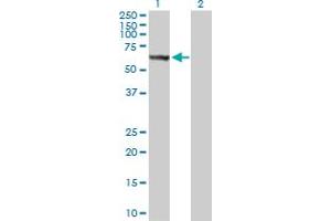 Western Blot analysis of STK33 expression in transfected 293T cell line by STK33 MaxPab polyclonal antibody. (STK33 抗体  (AA 1-514))
