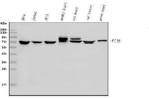 Western blot analysis of PI-16/PI16 using anti-PI-16/PI16 antibody (ABIN7601074).