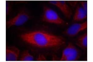 Image no. 2 for anti-Phospholipase C gamma 2 (PLCG2) (Tyr1217) antibody (ABIN319401)