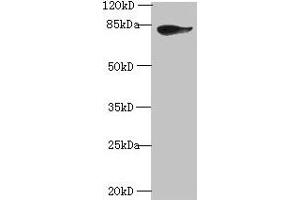 Western blot All lanes: JUP antibody at 2 μg/mL + A431 whole cell lysate Secondary Goat polyclonal to rabbit IgG at 1/10000 dilution Predicted band size: 82 kDa Observed band size: 82 kDa (JUP 抗体  (AA 1-131))