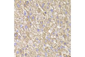 Immunohistochemistry of paraffin-embedded human liver injury using CIAPIN1 Antibody (ABIN1980352) at dilution of 1:100 (40x lens). (CIAPIN1 抗体)
