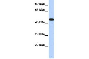 Western Blotting (WB) image for anti-A Kinase (PRKA) Anchor Protein 5 (AKAP5) antibody (ABIN2458236)