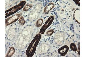 Image no. 1 for anti-Tripartite Motif Containing 45 (TRIM45) (AA 288-580) antibody (ABIN1491333) (TRIM45 抗体  (AA 288-580))