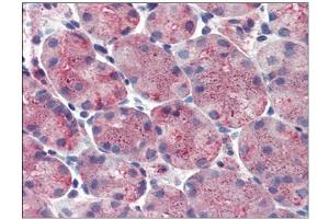 Stomach: Formalin-Fixed, Paraffin-Embedded (FFPE) (ERP44 抗体  (Internal Region))