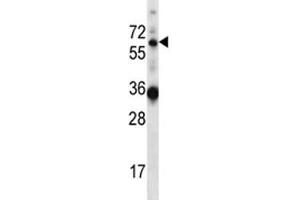GATAD2B antibody western blot analysis in mouse heart tissue lysate (GATAD2B 抗体  (AA 1-30))