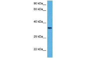 Host:  Rabbit  Target Name:  SLC25A32  Sample Tissue:  Human Jurkat Whole Cell  Antibody Dilution:  1ug/ml (SLC25A32 抗体  (N-Term))