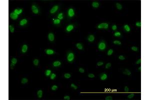 Immunofluorescence of monoclonal antibody to HSGT1 on HeLa cell. (ECD/SGT1 抗体  (AA 1-644))