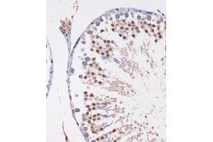 Immunohistochemistry of paraffin-embedded Rat testis using LYAR Rabbit pAb  at dilution of 1:100 (40x lens). (LYAR 抗体  (AA 10-160))