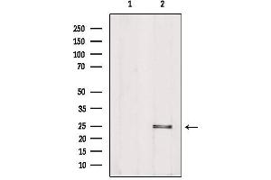Western blot analysis of extracts from Hela, using PIGF Antibody. (PIGF 抗体  (Internal Region))