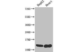 Western Blot Positive WB detected in: HepG2 whole cell lysate, Mouse heart tissue All lanes: WFDC2 antibody at 4 μg/mL Secondary Goat polyclonal to rabbit IgG at 1/50000 dilution Predicted band size: 13, 9, 12 kDa Observed band size: 13 kDa (WFDC2 抗体  (AA 31-124))
