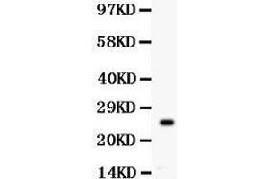 Anti- PSA Picoband antibody, Western blotting All lanes: Anti PSA  at 0. (Prostate Specific Antigen 抗体  (AA 25-261))