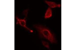 ABIN6277589 staining HeLa cells by IF/ICC. (CBR1 抗体  (C-Term))
