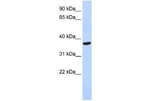 WB Suggested Anti-SPDYA Antibody Titration: 0. (SPDYA 抗体  (Middle Region))