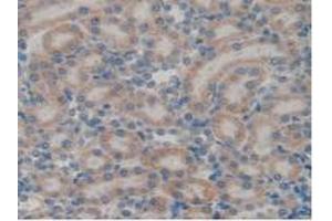 IHC-P analysis of Rat Kidney Tissue, with DAB staining. (GATA4 抗体  (AA 228-440))