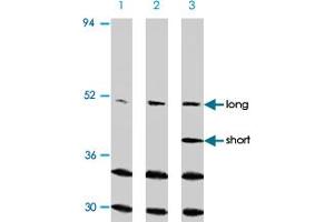 Western blot analysis of CASP2 in Ramos cells with CASP2 polyclonal antibody at (A) 0. (Caspase 2 抗体  (N-Term))