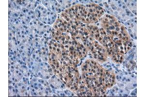 Image no. 11 for anti-Acetyl-CoA Acetyltransferase 2 (ACAT2) antibody (ABIN1496404)