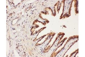 IHC-P: ALOX15 antibody testing of rat lung tissue (ALOX15 抗体  (AA 2-337))
