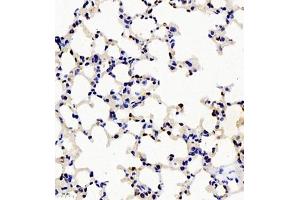 Immunohistochemistry (Paraffin-embedded Sections) (IHC (p)) image for anti-Telomeric Repeat Binding Factor 2, Interacting Protein (TERF2IP) antibody (ABIN7075857)