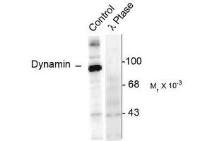 Image no. 1 for anti-Dynamin 1 (DNM1) (pSer774) antibody (ABIN372616) (Dynamin 1 抗体  (pSer774))