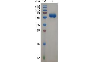 Human F Protein, hFc Tag on SDS-PAGE under reducing condition.