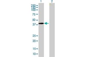 Western Blot analysis of ZNF547 expression in transfected 293T cell line by ZNF547 MaxPab polyclonal antibody. (ZNF547 抗体  (AA 1-402))
