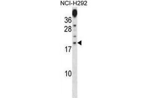 Western blot analysis in NCI-H292 cell line lysates (35ug/lane) using PRR15 Antibody (C-term).