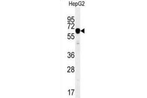 Western Blotting (WB) image for anti-Insulin-Like Growth Factor 2 mRNA Binding Protein 2 (IGF2BP2) antibody (ABIN2995531) (IGF2BP2 抗体)