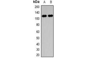 Western blot analysis of Collagen 28 alpha 1 expression in HepG2 (A), NIH3T3 (B) whole cell lysates. (COL28A1 抗体  (N-Term))