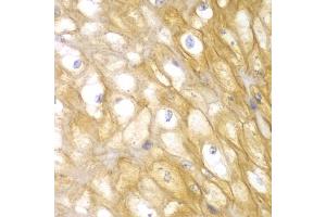 Immunohistochemistry of paraffin-embedded human esophagus using ACTN1 antibody (ABIN5970506) at dilution of 1/100 (40x lens). (ACTN1 抗体)
