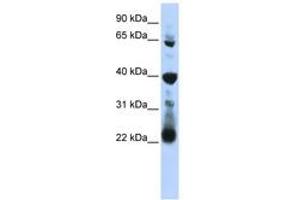 Image no. 1 for anti-RNA Pseudouridylate Synthase Domain Containing 3 (RPUSD3) (AA 251-300) antibody (ABIN6743049) (RPUSD3 抗体  (AA 251-300))
