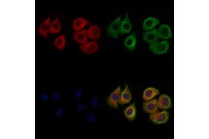 ABIN6262448 and ABIN6272326 staining Hela cells by IF/ICC.