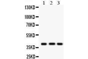 Anti- HLA-A Picoband antibody, Western blotting All lanes: Anti HLA-A  at 0. (HLA-A 抗体  (N-Term))