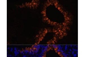 Immunofluorescence analysis of Mouse lung cells using SCGB1A1 Polyclonal Antibody at dilution of 1:100. (SCGB1A1 抗体)